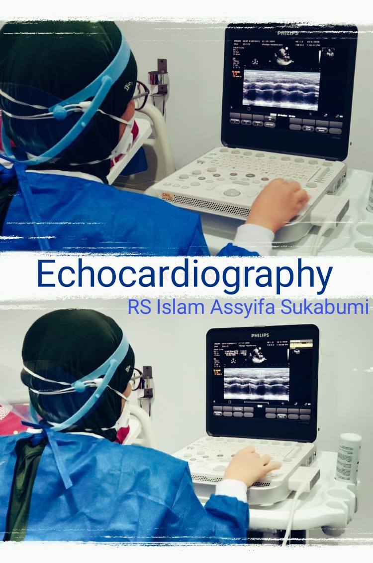 RS Islam Assyifa telah dilengkapi dengan Echocardiography